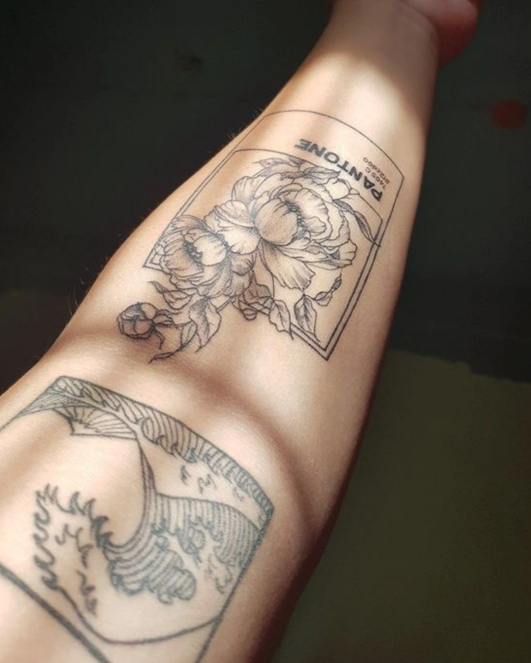 Remoção de Tatuagem