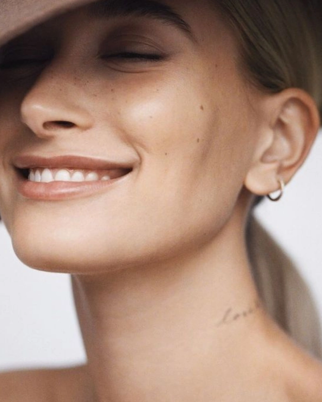 Remoção de Verrugas